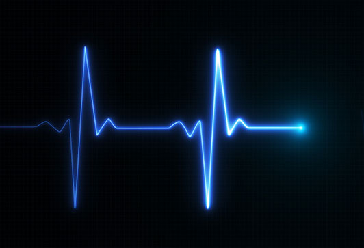 Image of heartbeat on a monitoring device, EKG